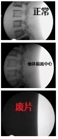 c臂机怎么开机手术室C臂机的辐射防护_https://www.jmylbn.com_新闻资讯_第7张