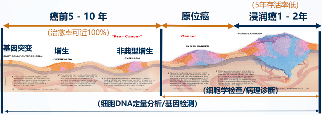 细胞分析检查什么【项目推介】宫颈癌筛查特色项目--细胞DNA定量分析联合液基细胞学检查_https://www.jmylbn.com_新闻资讯_第5张