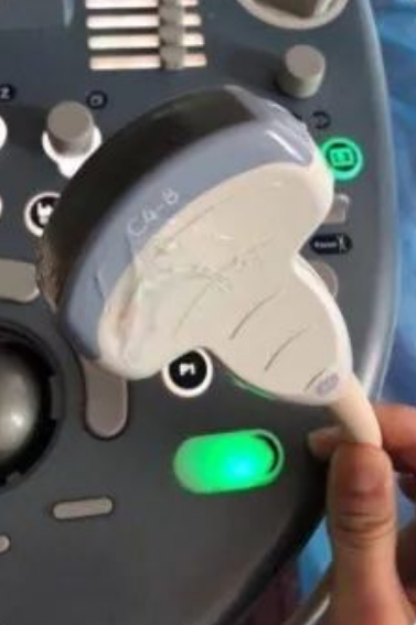 卡瓦布消毒巾怎么样养护宝典 ｜ 超声探头清洁消毒指南_https://www.jmylbn.com_新闻资讯_第2张