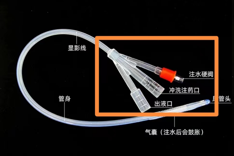 三腔导尿管怎么使用产品｜导尿管_https://www.jmylbn.com_新闻资讯_第6张