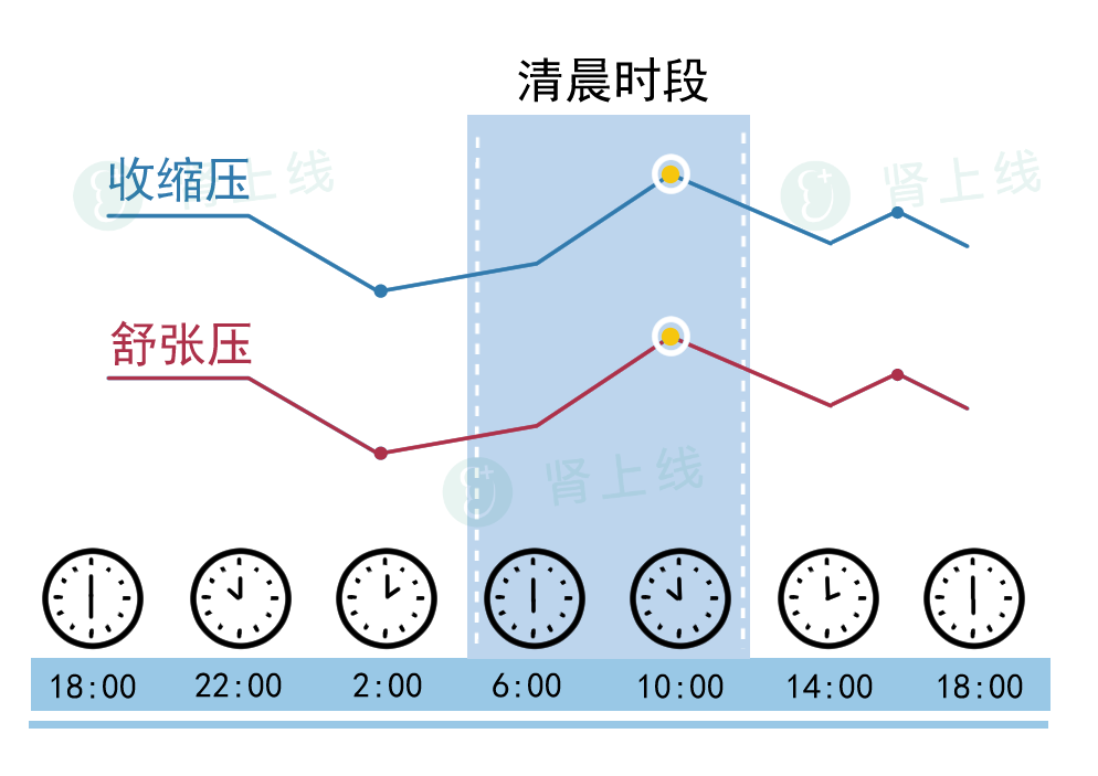 超勺型血压图片