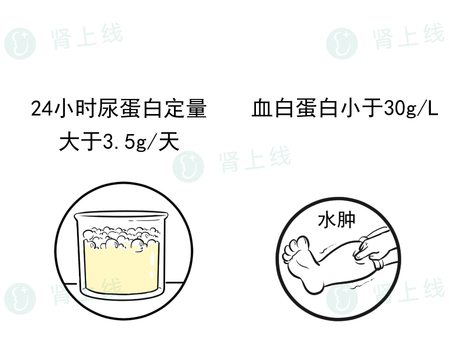 局灶节段性肾小球硬化 Fsgs 的60条常识 分享给需要了解的朋友 Hi有料