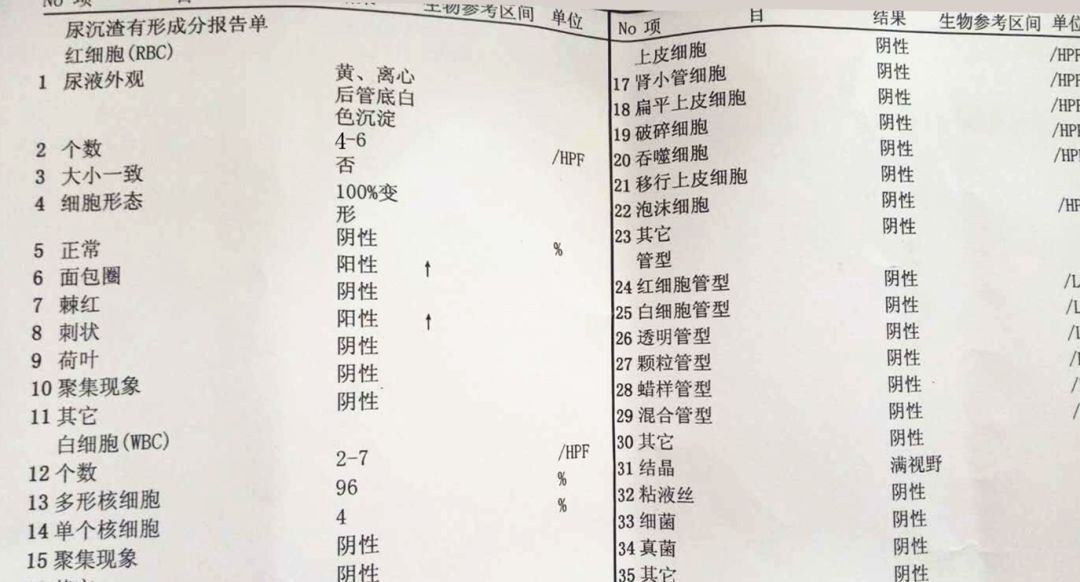 沒腎穿刺前，怎麼判斷「腎炎」類型？ 健康 第3張