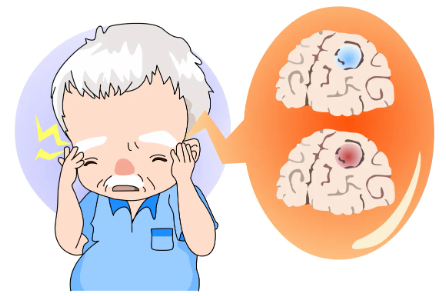 什么三氧输血三氧自体血回输疗法助力脑缺血患者康复-上海聚慕医疗器械有限公司