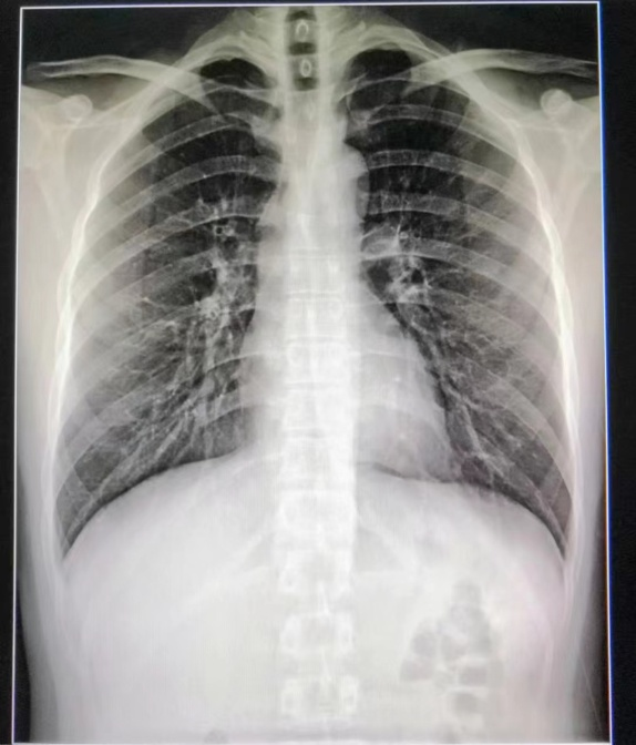 x射线为什么叫dr【健康科普】DR、CT 傻傻分不清楚？带你解读_https://www.jmylbn.com_新闻资讯_第2张