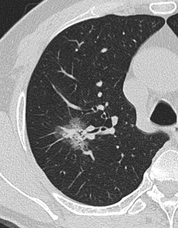 x射线为什么叫dr【健康科普】DR、CT 傻傻分不清楚？带你解读_https://www.jmylbn.com_新闻资讯_第8张
