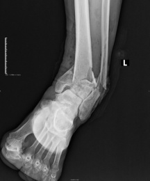 x射线为什么叫dr【健康科普】DR、CT 傻傻分不清楚？带你解读_https://www.jmylbn.com_新闻资讯_第3张