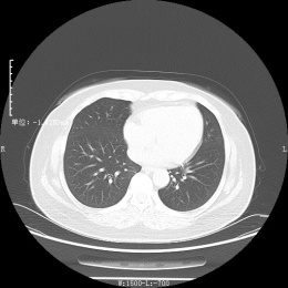 x射线为什么叫dr【健康科普】DR、CT 傻傻分不清楚？带你解读_https://www.jmylbn.com_新闻资讯_第6张