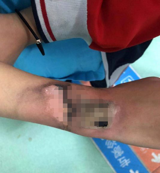 小孩戴的手表电话_专家不建议小孩戴电话手表_小孩戴手表电话对身体有害吗
