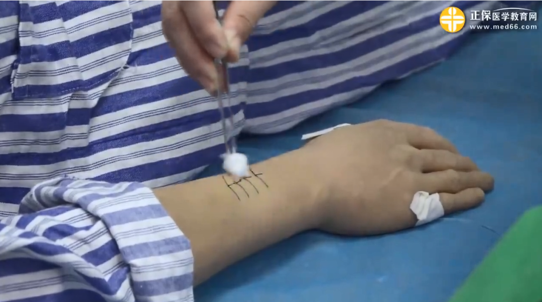 换药碗里有哪些器械【技能重点】中医执业-伤口（切口）换药操作_https://www.jmylbn.com_新闻资讯_第4张