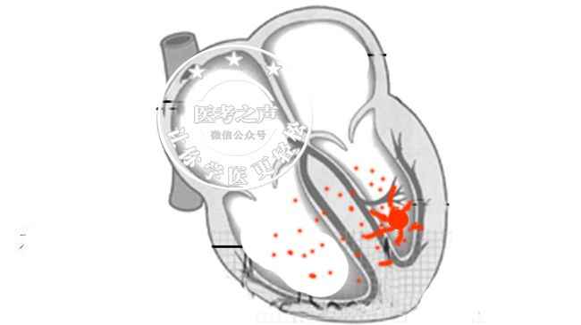 心电监护怎么看图图文并茂最全心电图，值得转发收藏_https://www.jmylbn.com_新闻资讯_第20张