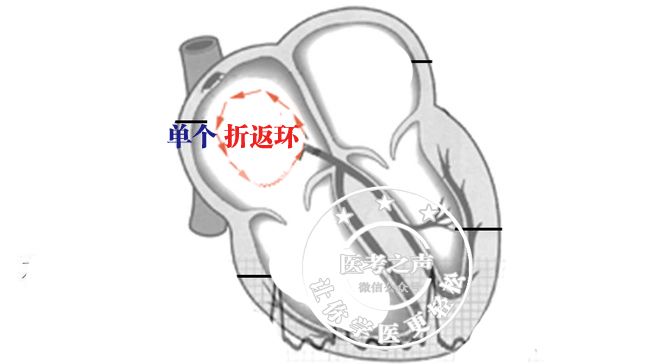 学习心电图，这是我见过最完美的文章！