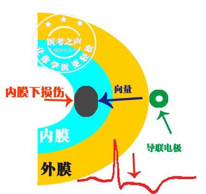 学习心电图，这是我见过最完美的文章！