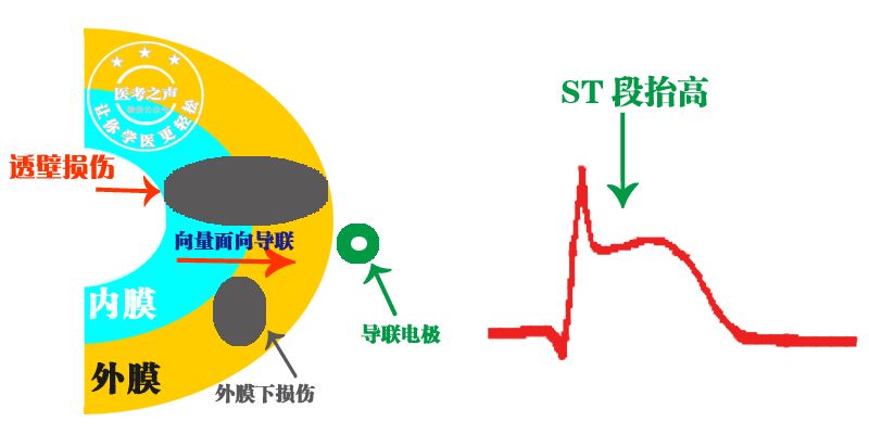 学习心电图，这是我见过最完美的文章！