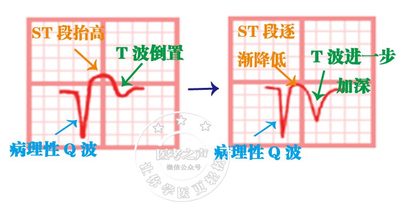 学习心电图，这是我见过最完美的文章！