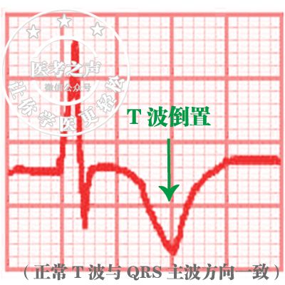 学习心电图，这是我见过最完美的文章！