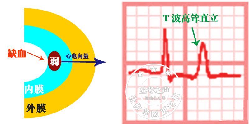 学习心电图，这是我见过最完美的文章！