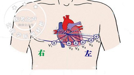学习心电图，这是我见过最完美的文章！