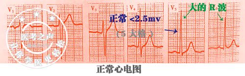学习心电图，这是我见过最完美的文章！