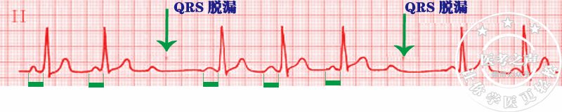 学习心电图，这是我见过最完美的文章！