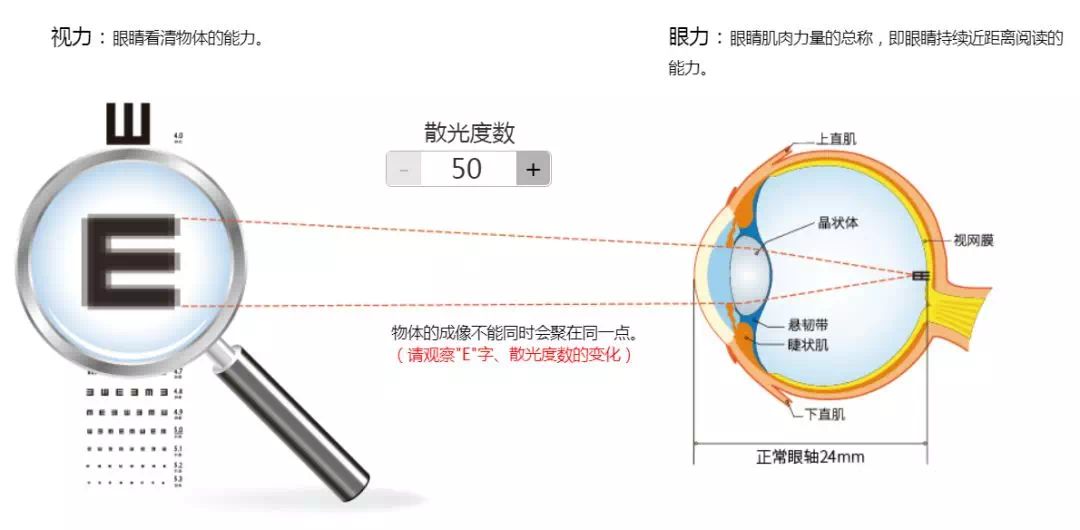 散光太让人抓狂，难怪孩子期末考试考差了！