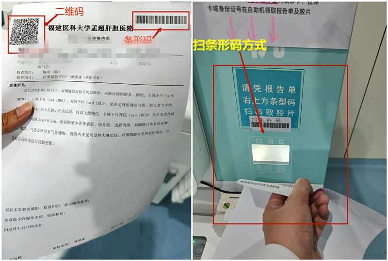 怎么自助取胶片医院如何便捷地获取影像报告和胶片？读完就懂了_https://www.jmylbn.com_新闻资讯_第7张
