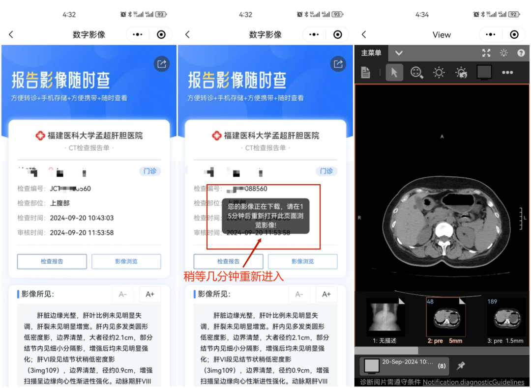 怎么自助取胶片医院如何便捷地获取影像报告和胶片？读完就懂了_https://www.jmylbn.com_新闻资讯_第9张