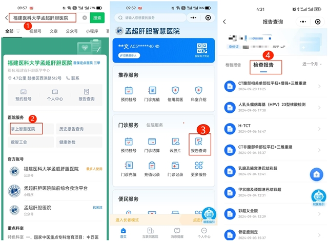 怎么自助取胶片医院如何便捷地获取影像报告和胶片？读完就懂了_https://www.jmylbn.com_新闻资讯_第8张