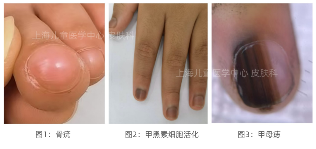 (Imag from Chinese network) 