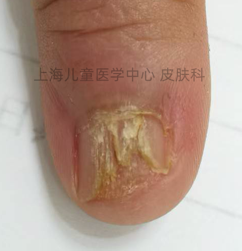 (Imag from Chinese network) 