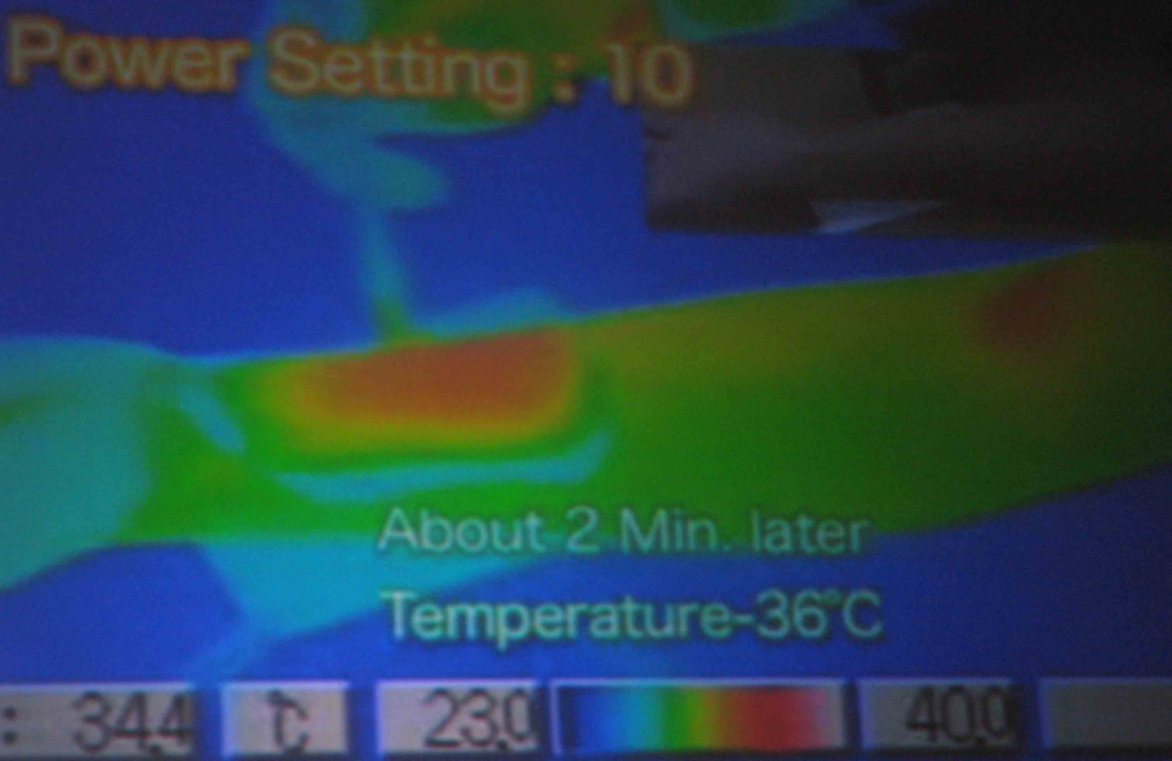 高频手术设备有哪些【宝藏设备】高频射频手术适用于哪些疾病？_https://www.jmylbn.com_新闻资讯_第4张