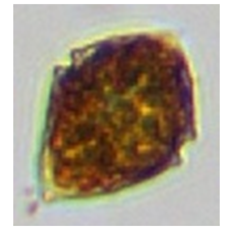 譜康醫(yī)學 | 流式成像技術(shù)助力浮游植物（藻類）檢測進入新時代