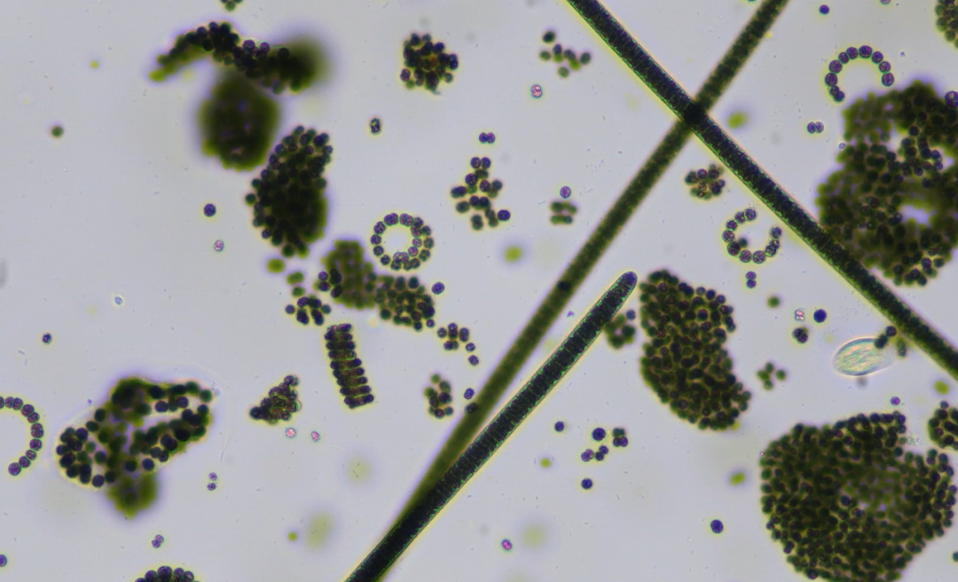 譜康醫(yī)學 | 流式成像技術(shù)助力浮游植物（藻類）檢測進入新時代