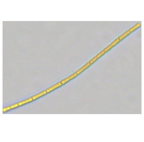 譜康醫(yī)學 | 流式成像技術(shù)助力浮游植物（藻類）檢測進入新時代