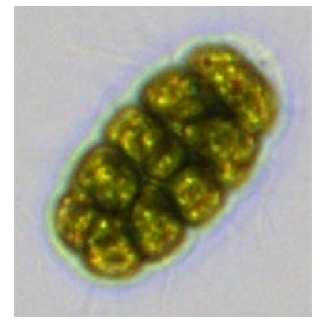 譜康醫(yī)學 | 流式成像技術(shù)助力浮游植物（藻類）檢測進入新時代