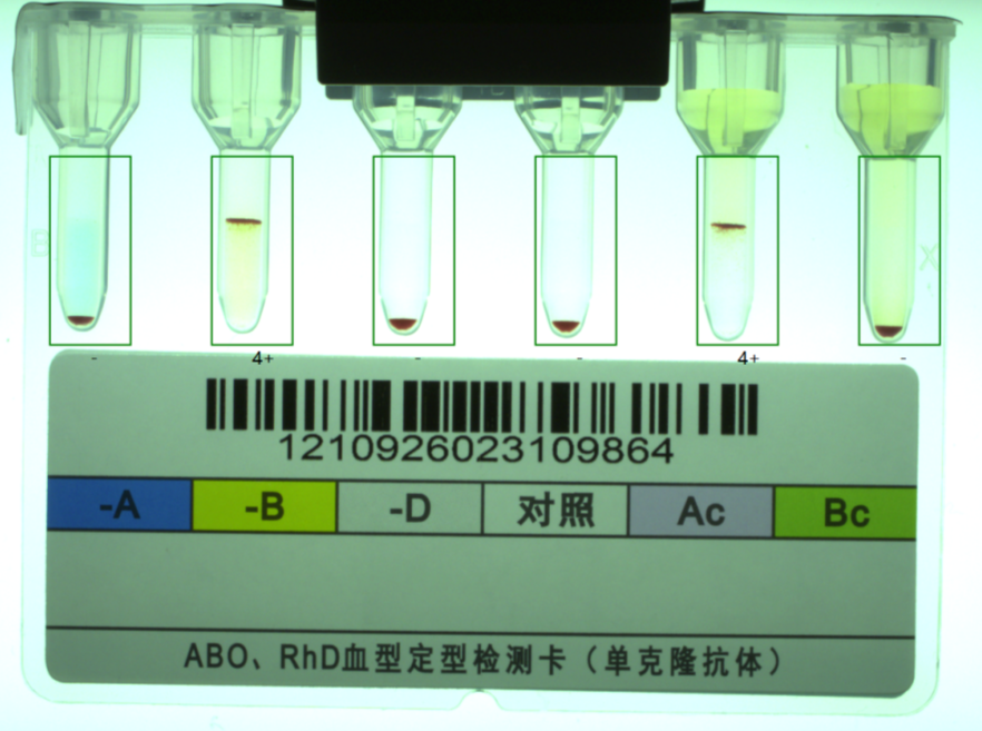 微柱凝胶法结果图片图片