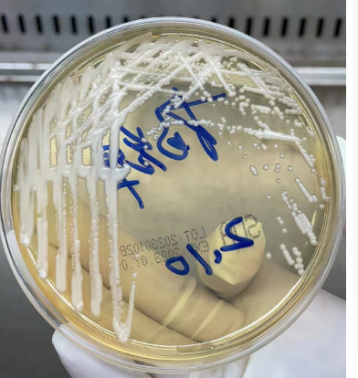 新型隐球菌感染引起的多发性疾病
