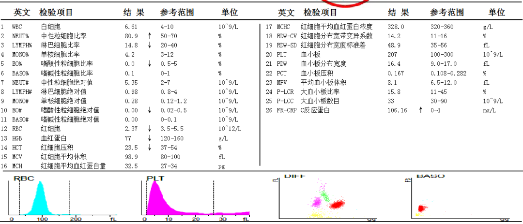 ESR在医学上什么意思这个血，“沉”得不一样_https://www.jmylbn.com_新闻资讯_第9张