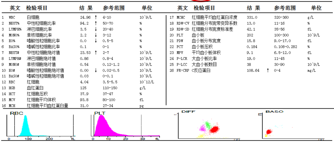ESR在医学上什么意思这个血，“沉”得不一样_https://www.jmylbn.com_新闻资讯_第3张
