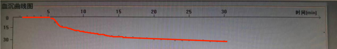 ESR在医学上什么意思这个血，“沉”得不一样_https://www.jmylbn.com_新闻资讯_第5张