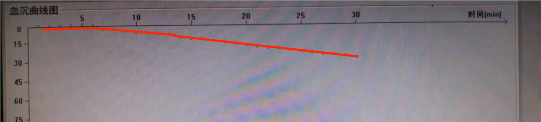 ESR在医学上什么意思这个血，“沉”得不一样_https://www.jmylbn.com_新闻资讯_第8张
