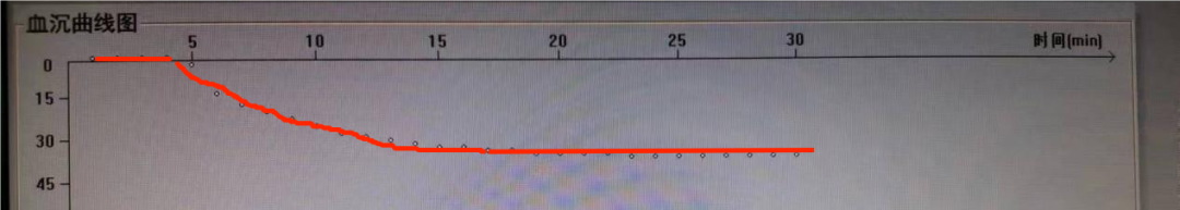 ESR在医学上什么意思这个血，“沉”得不一样_https://www.jmylbn.com_新闻资讯_第14张
