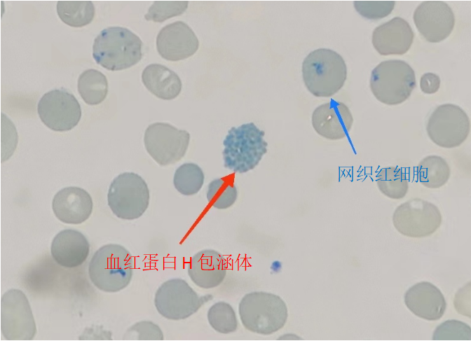 犬瘟热包涵体图片图片