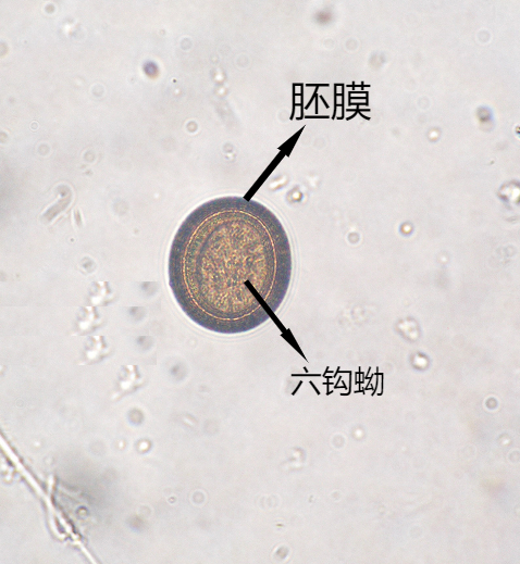 寄生虫虫卵图片大全图片