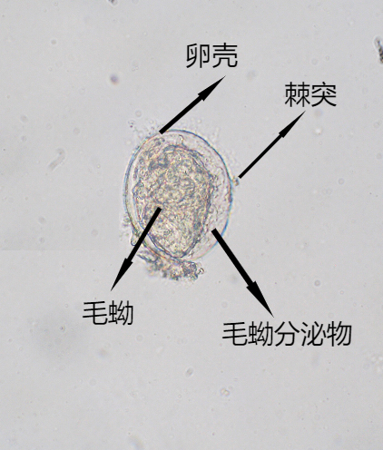 虫卵大全图解图片