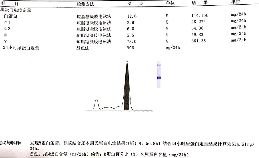 尿液蛋白电泳:血清蛋白电泳:生化检测结果:进一步检查报告如下:检测