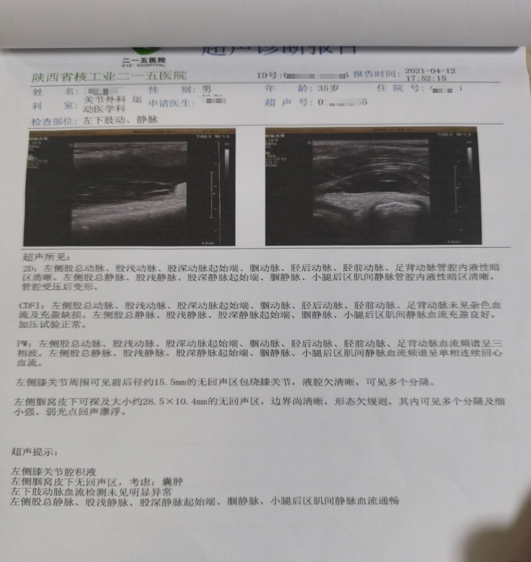 痛风肾超声报告图片图片