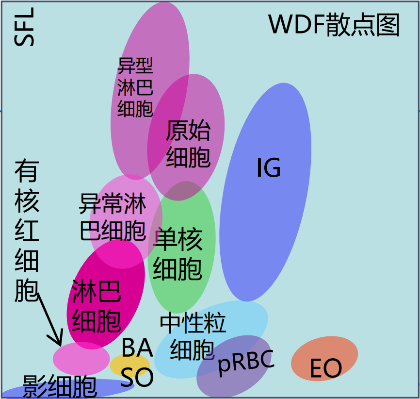 病人白细胞及血小板减低,散点图异常,有部分散点在单核细胞区域上方