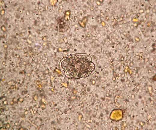 昨日「虫」现-在检验科养钩虫是一种什么样的体验?