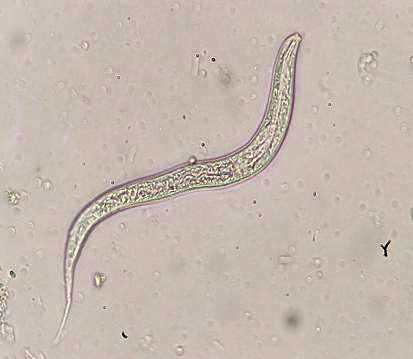 包括17属约100种,寄生于人体的钩虫主要有十二指肠钩口线虫和美洲板口